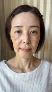 肌が綺麗な女性