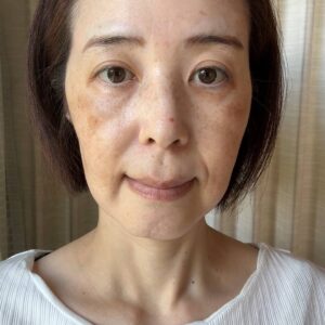 肌が綺麗な女性