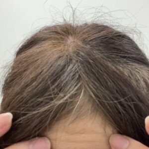 50代_おでこのシワを触る女性