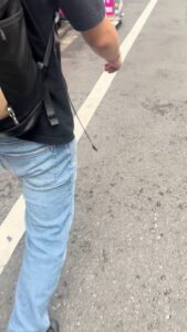 大人のお店にどうしても行きたい男性｜脱毛｜植毛