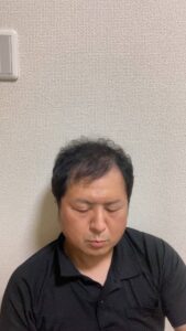 育毛剤をつける男性｜薄毛｜育毛剤