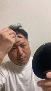 おでこにペンで髪を描く男性｜育毛｜美容