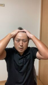 薄毛を気にする男性｜薄毛｜悩み