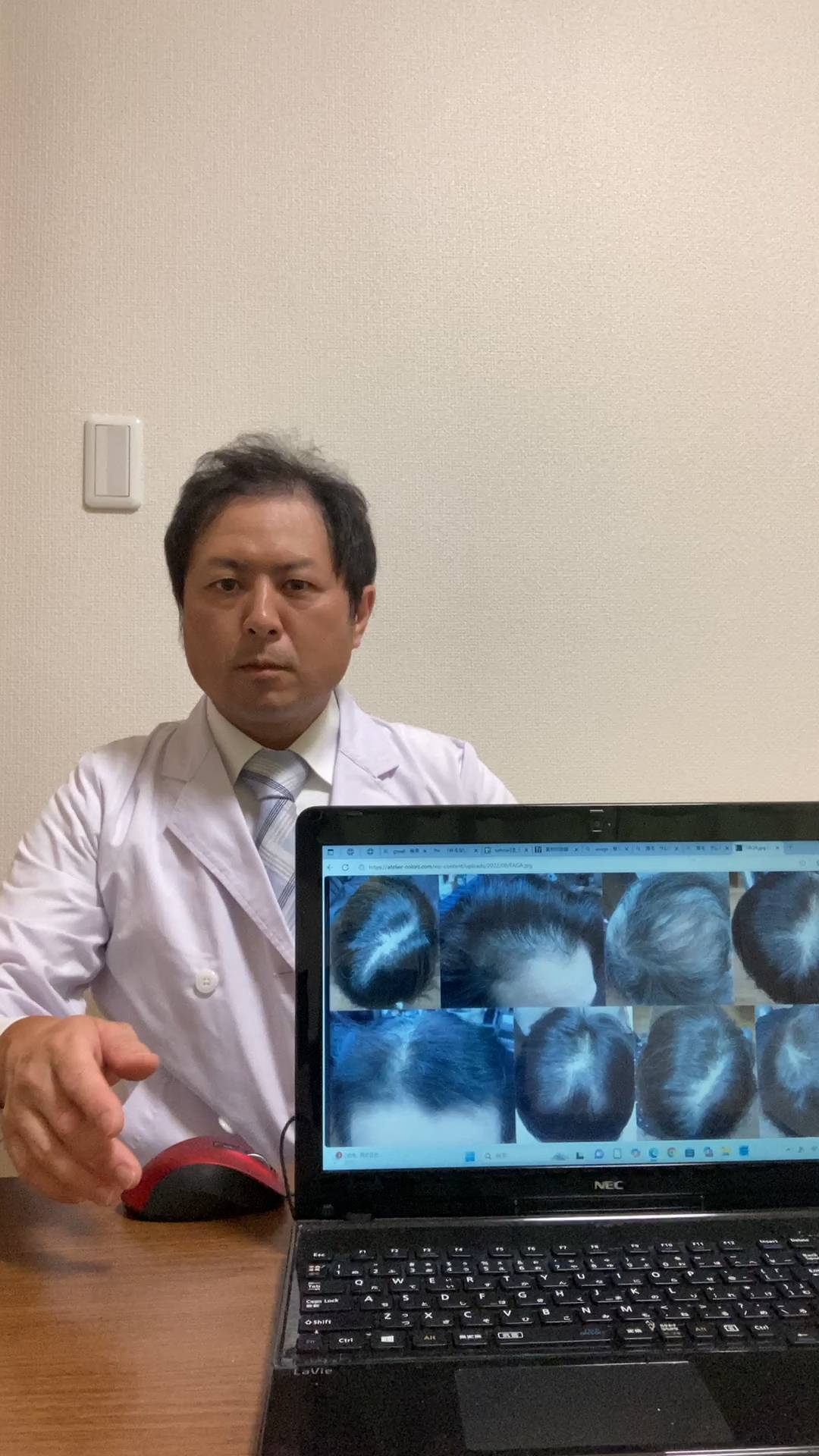 先生から薄毛の説明を受ける男性｜ドクター｜説明｜薄毛