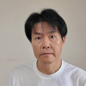 薄毛を気にする男性｜AGA