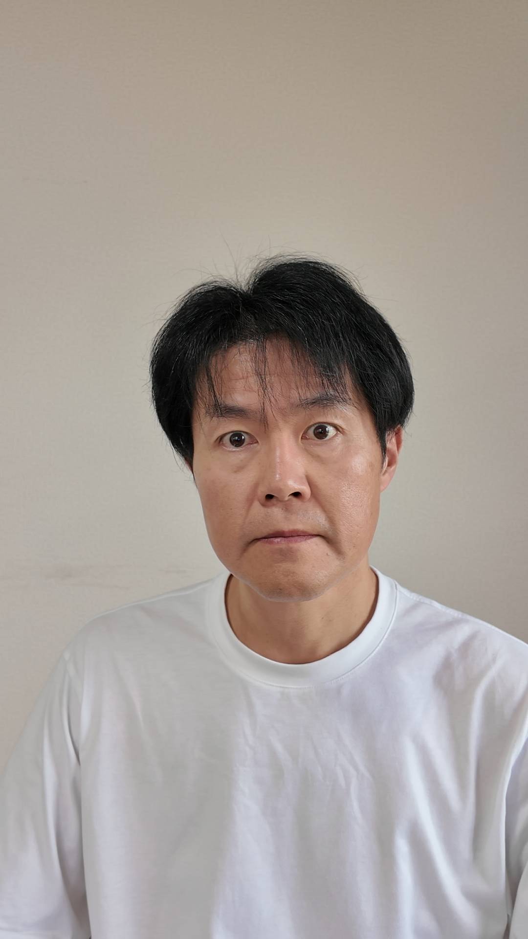 薄毛を気にする男性｜AGA