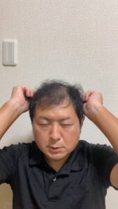 毛根をアピールする男性｜ヘアケア