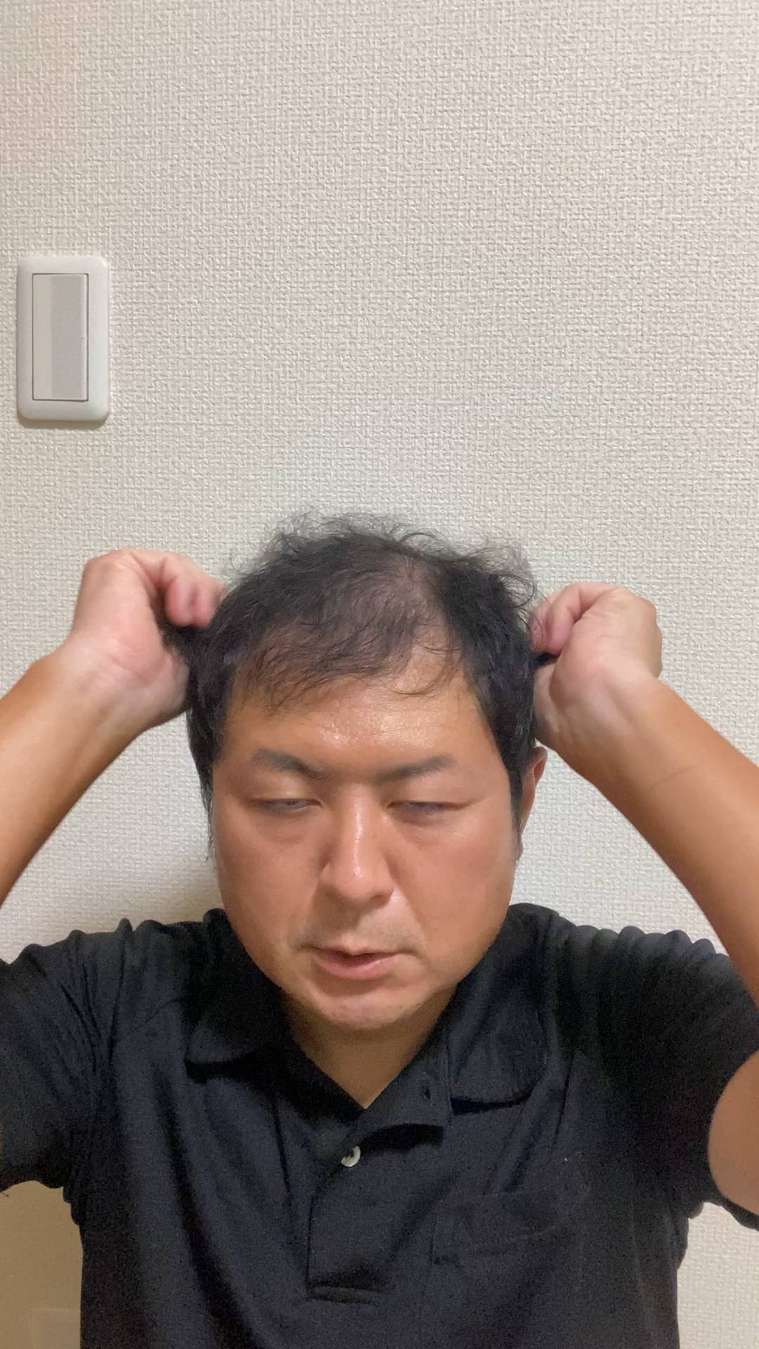 毛根をアピールする男性｜ヘアケア