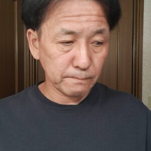 薄毛の男性｜AGA