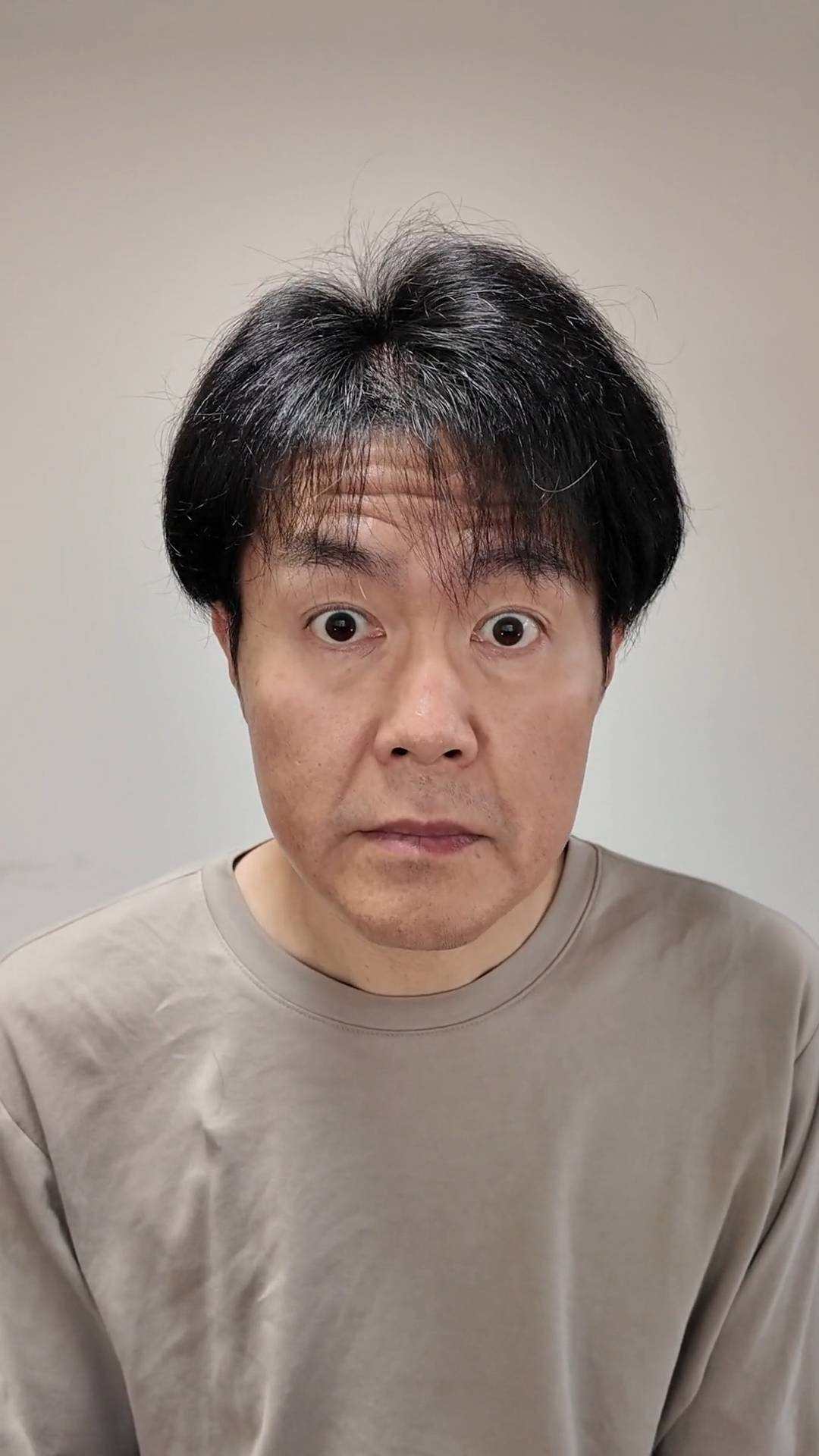 おでこのシワを気にする男性｜スキンケア｜コンプレックス