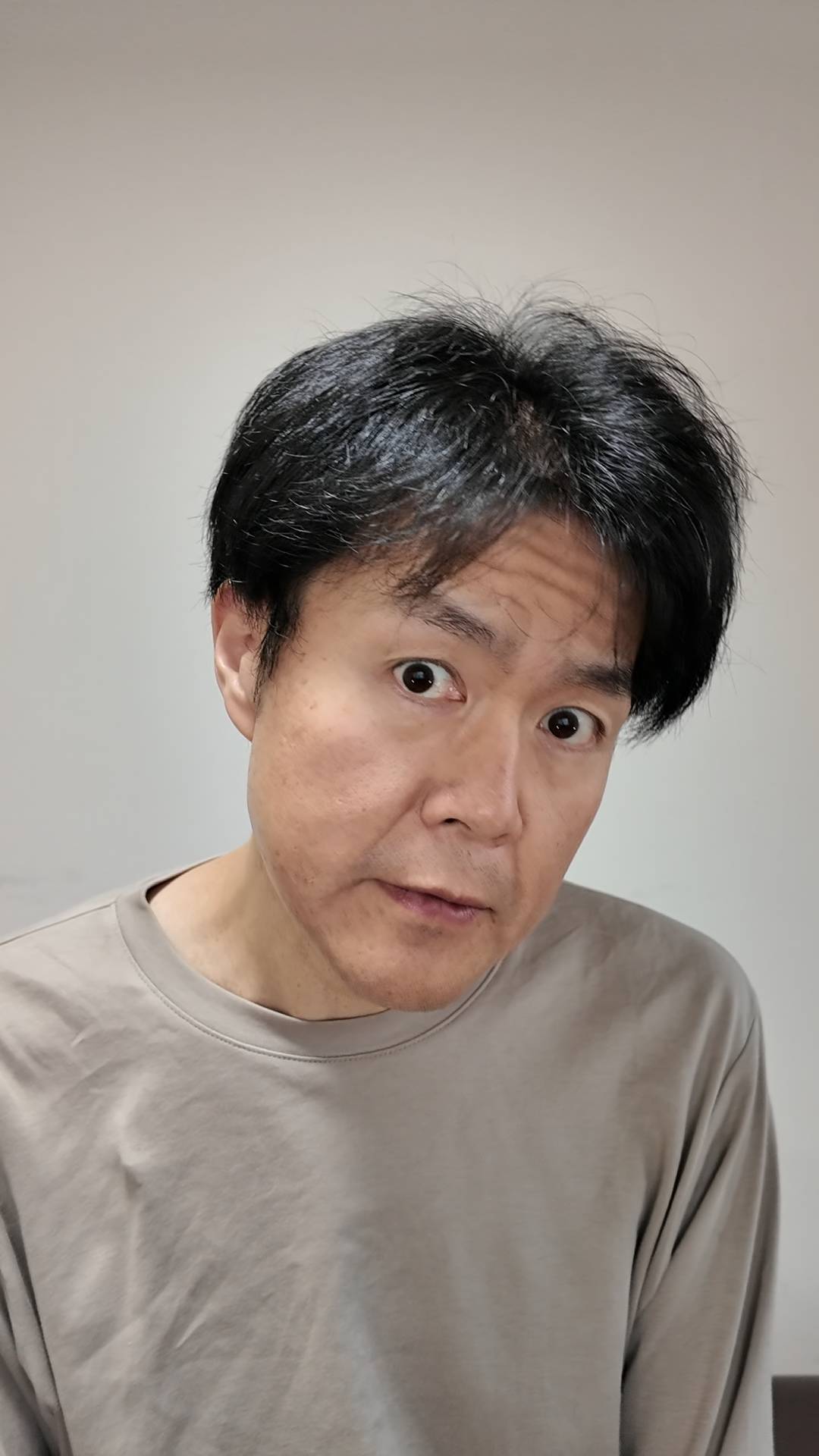 生え際を気にしている男性｜ヘアケア｜薄毛