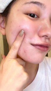 モチモチ肌を指で触る女性｜モチモチ肌｜スキンケア