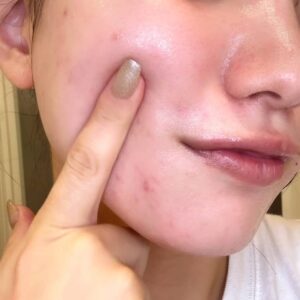 モチモチ肌を指で触る女性｜モチモチ肌｜スキンケア