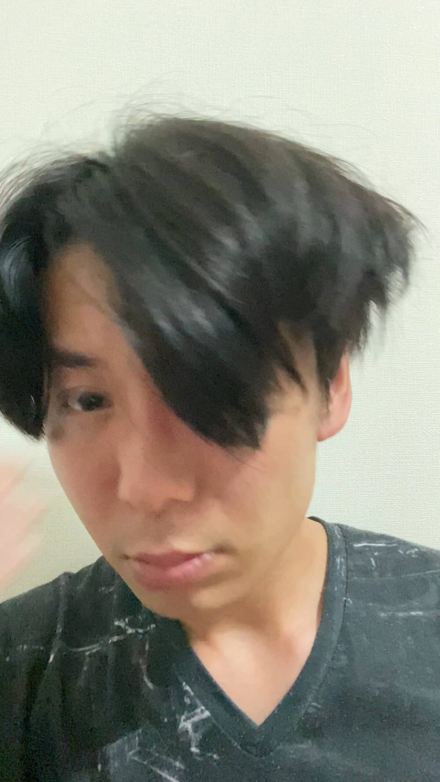 生え際をチェックする男性｜薄毛｜育毛｜植毛