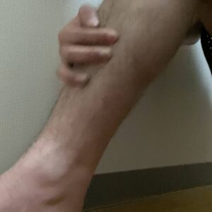 足のすね毛が気になる男性｜脱毛｜脛毛